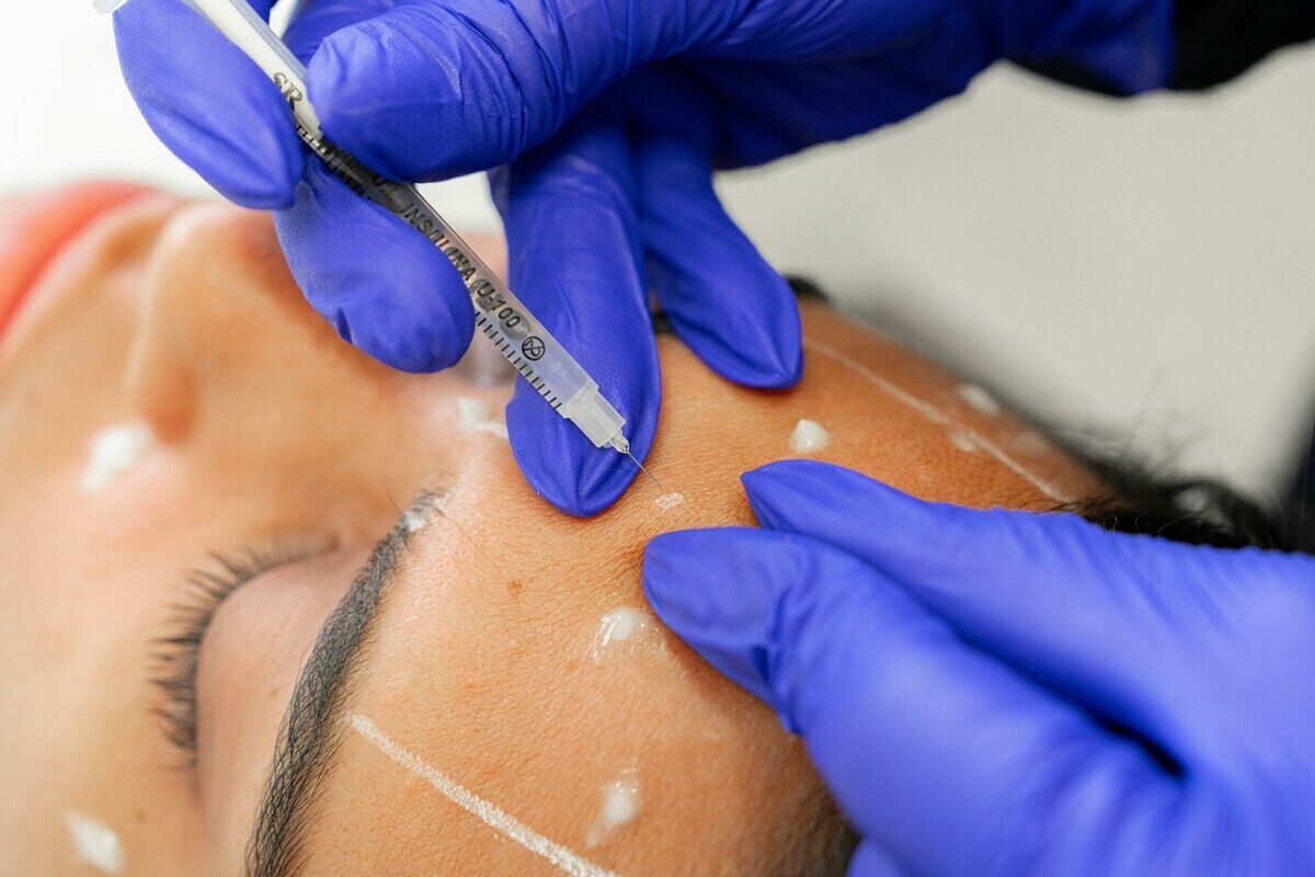 2-injection_forehead